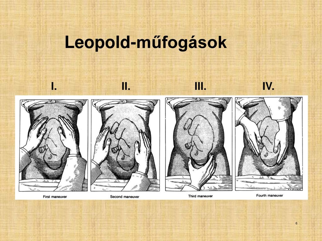 Leopold-műfogások I. II. III. IV.