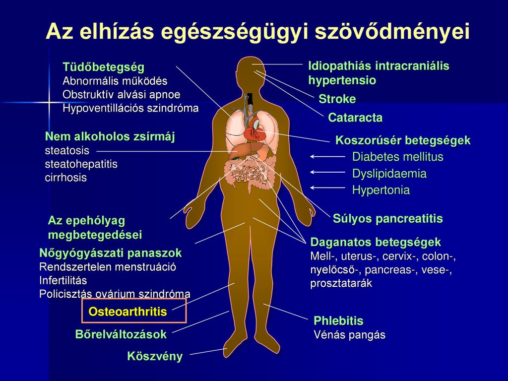 elhízás és ízületi betegségek)