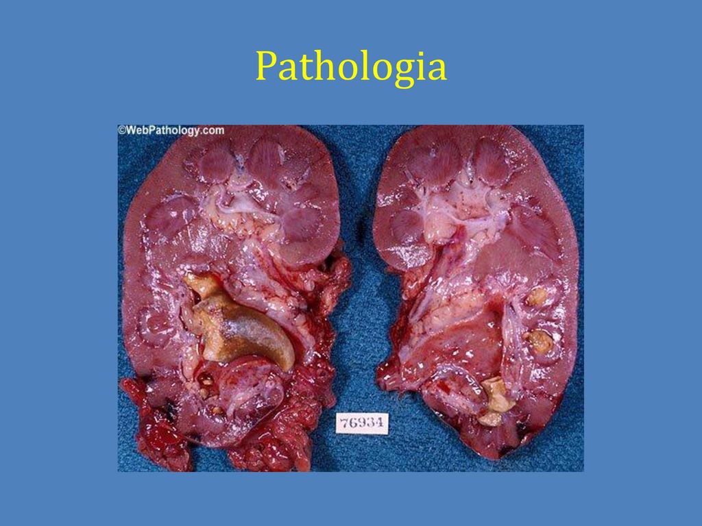 Pathologia