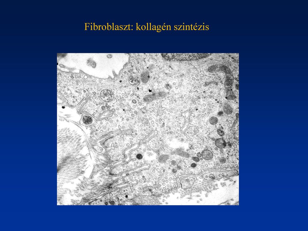 Fibroblaszt: kollagén szintézis