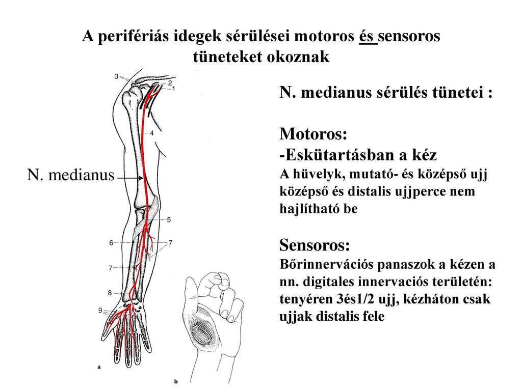 A perifériás idegek sérülései motoros és sensoros tüneteket okoznak