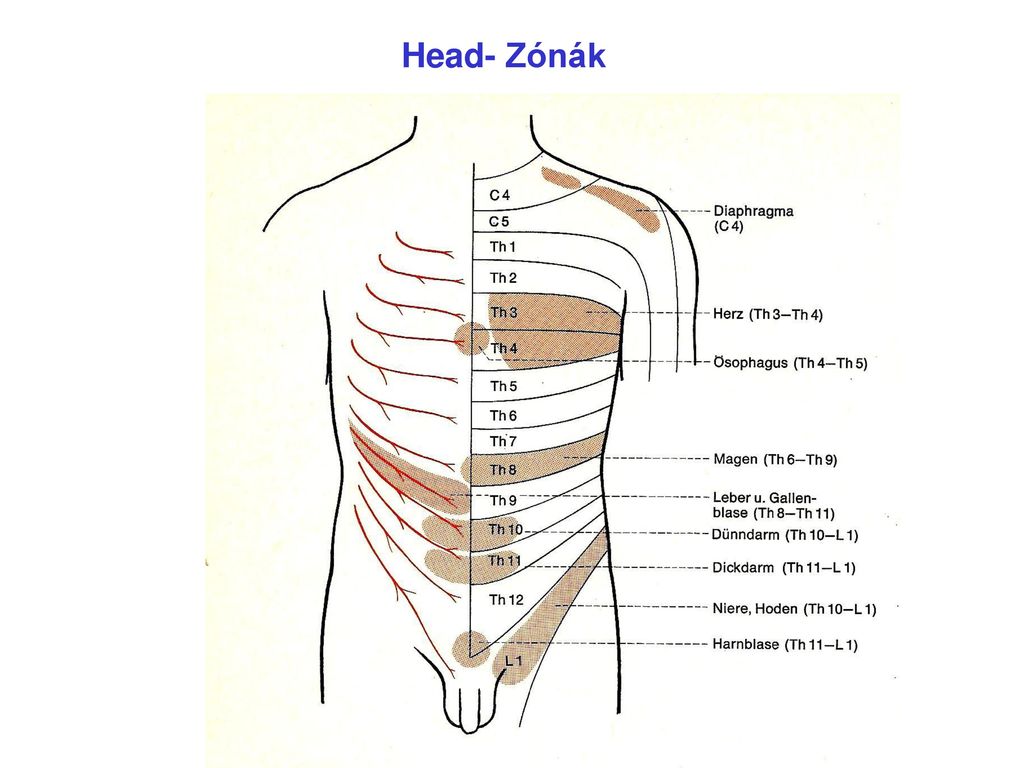 Head- Zónák