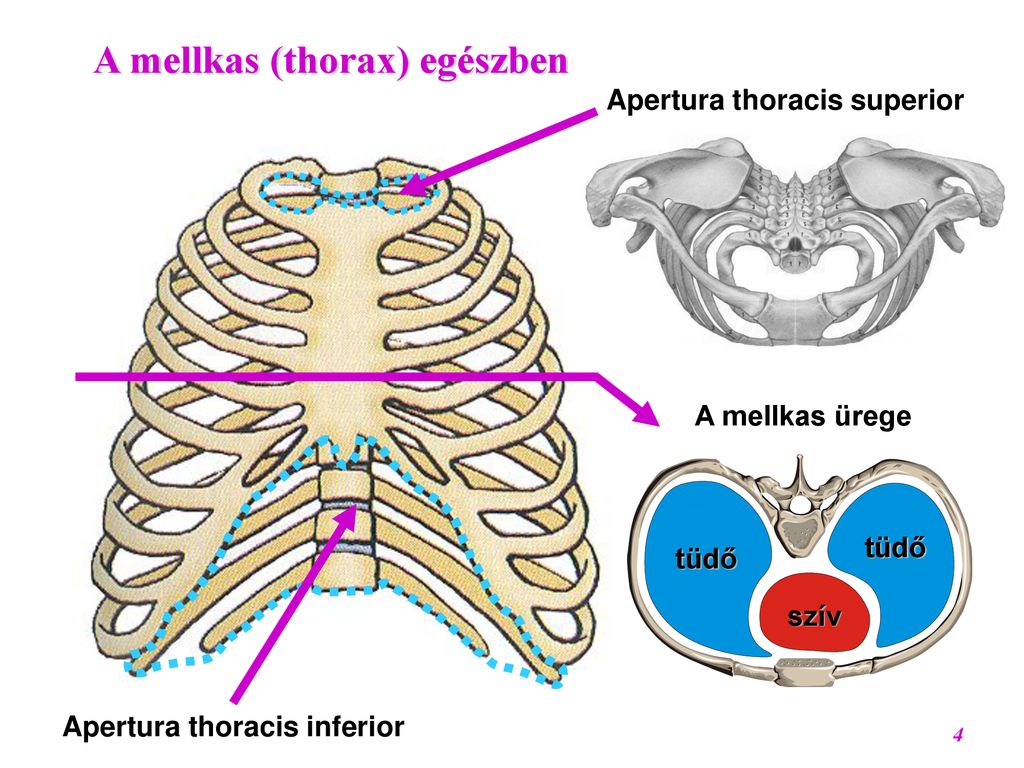 Грудное отверстие. Мембрана верхней апертуры грудной клетки. Apertura Thoracis Superior анатомия. Апертура торацис Супериор. Верхняя Апертура грудной клетки.