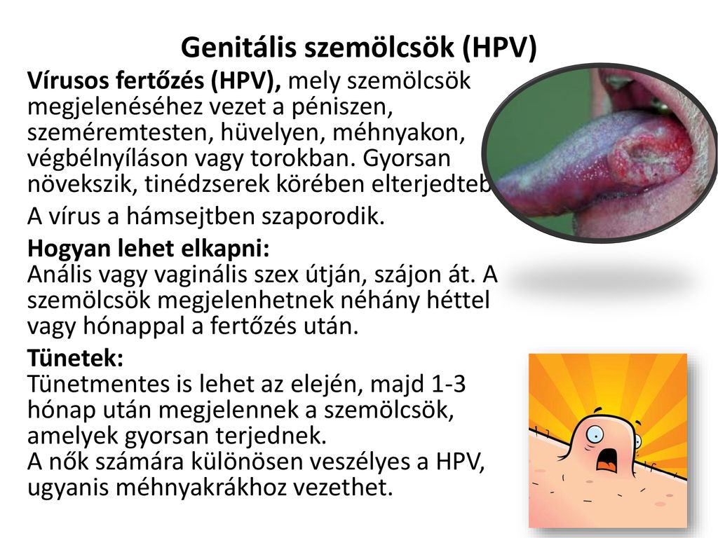 A szifilisz tünetei a péniszen - radiocell.hu