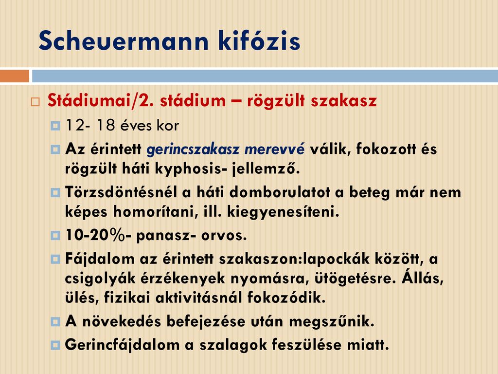 Scheuermann kifózis Stádiumai/2. stádium – rögzült szakasz