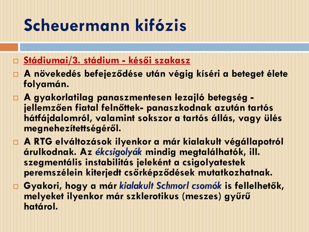 Scheuermann kifózis Stádiumai/3. stádium - késői szakasz