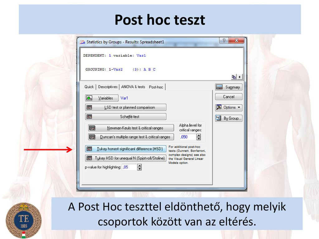 Post hoc teszt A Post Hoc teszttel eldönthető, hogy melyik csoportok között van az eltérés.