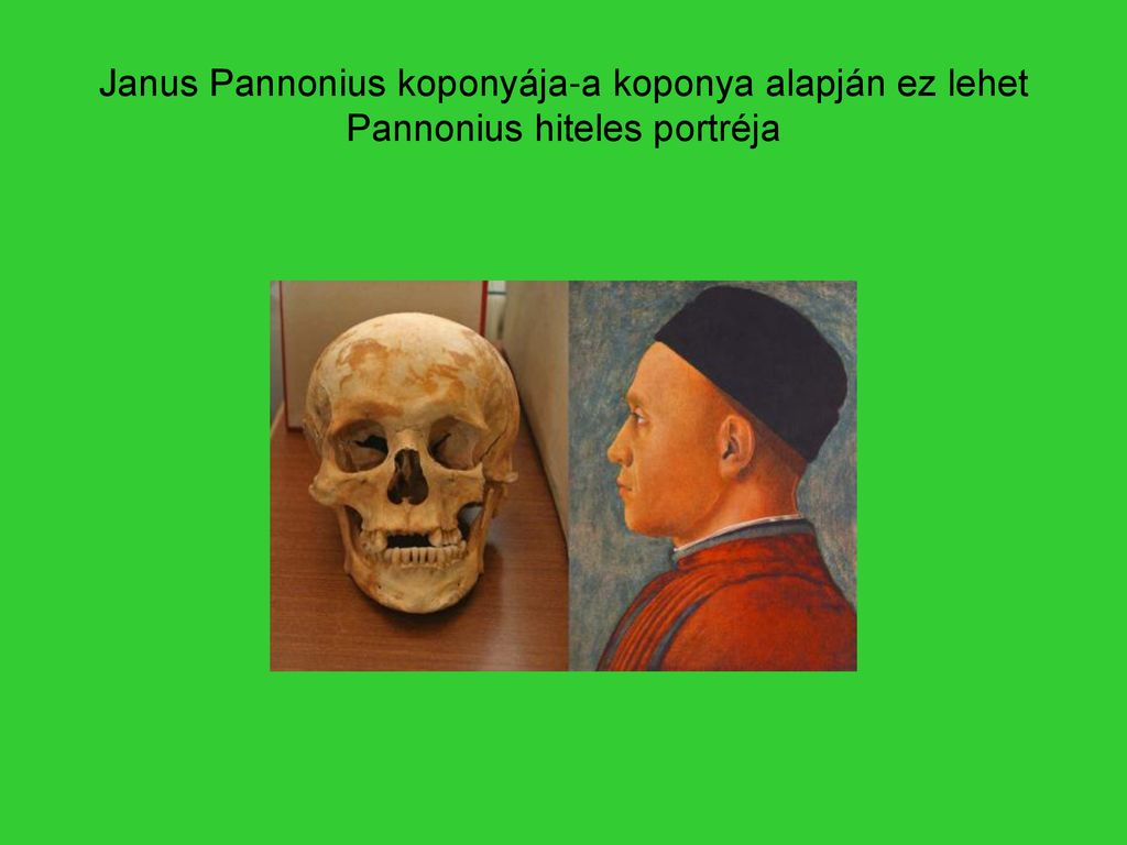 Janus Pannonius koponyája-a koponya alapján ez lehet Pannonius hiteles portréja