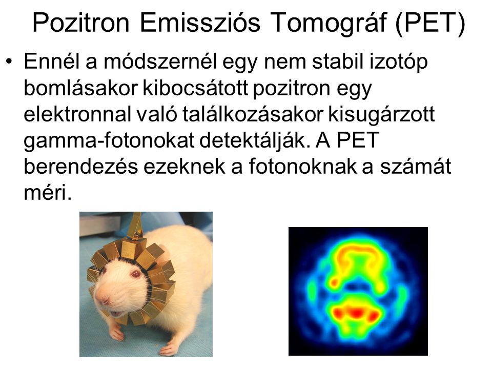 Pozitron Emissziós Tomográf (PET)
