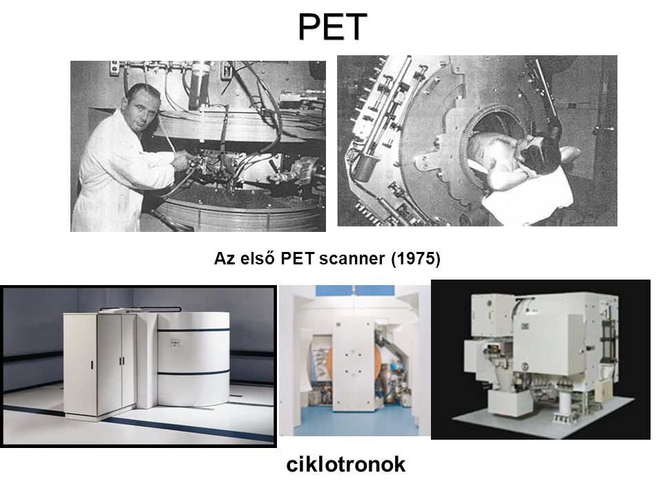 PET Az első PET scanner (1975) ciklotronok