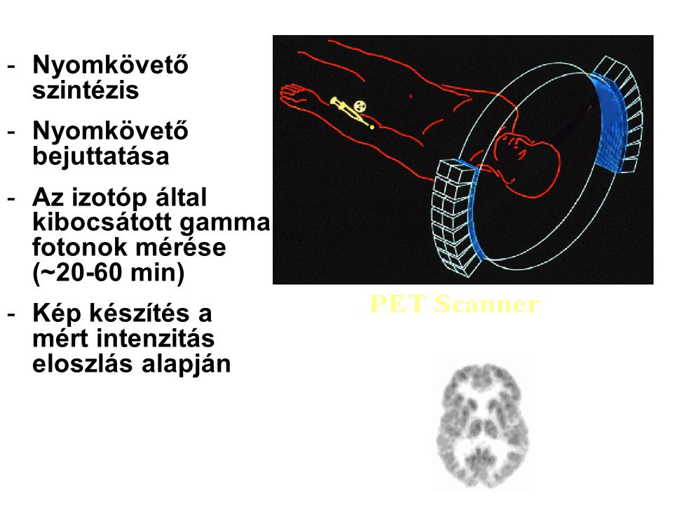 PET Imaging Overview Nyomkövető szintézis Nyomkövető bejuttatása