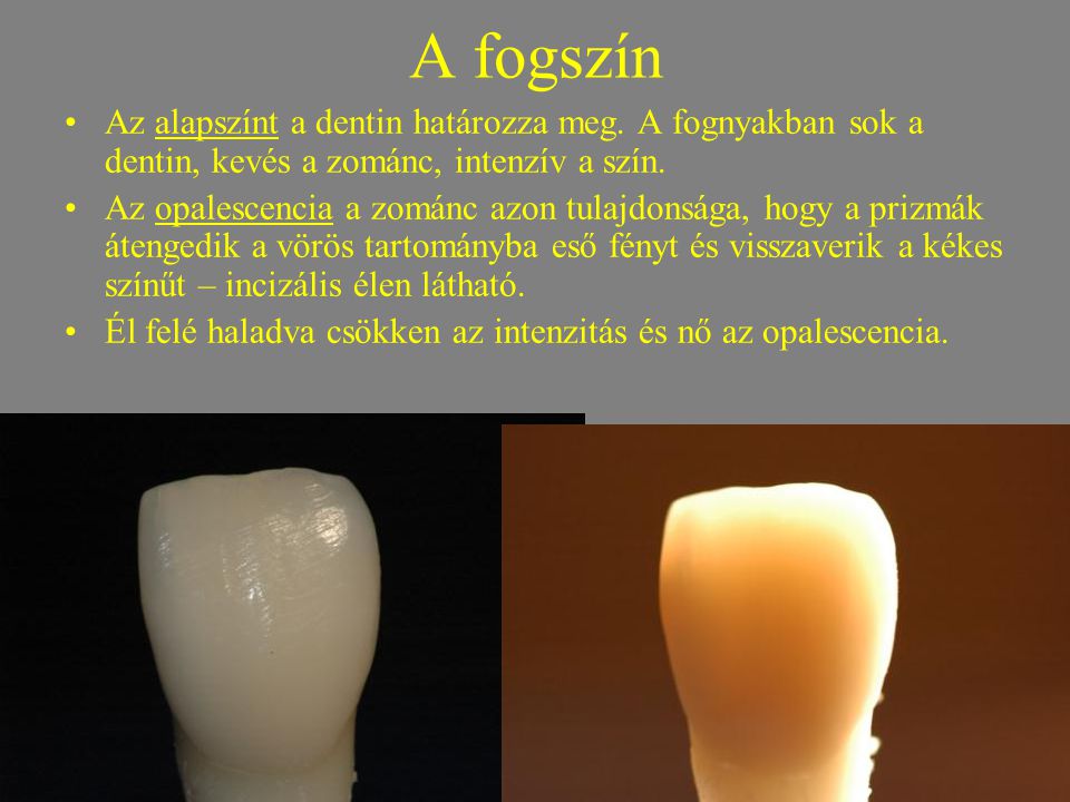 A fogszín Az alapszínt a dentin határozza meg. A fognyakban sok a dentin, kevés a zománc, intenzív a szín.