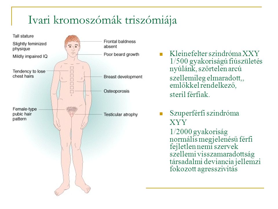 Ivari kromoszómák triszómiája