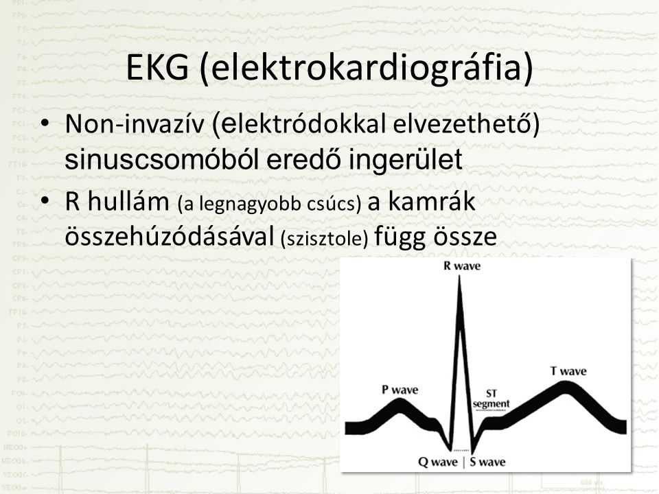 EKG (elektrokardiográfia)
