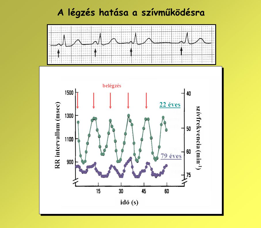 szívfrekvencia (min-1)