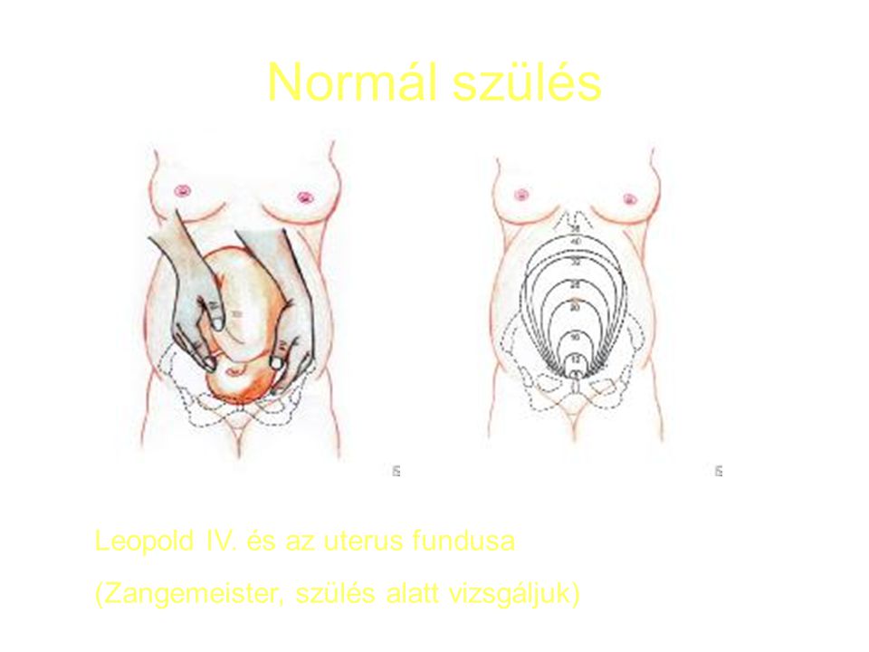 Normál szülés Leopold IV. és az uterus fundusa