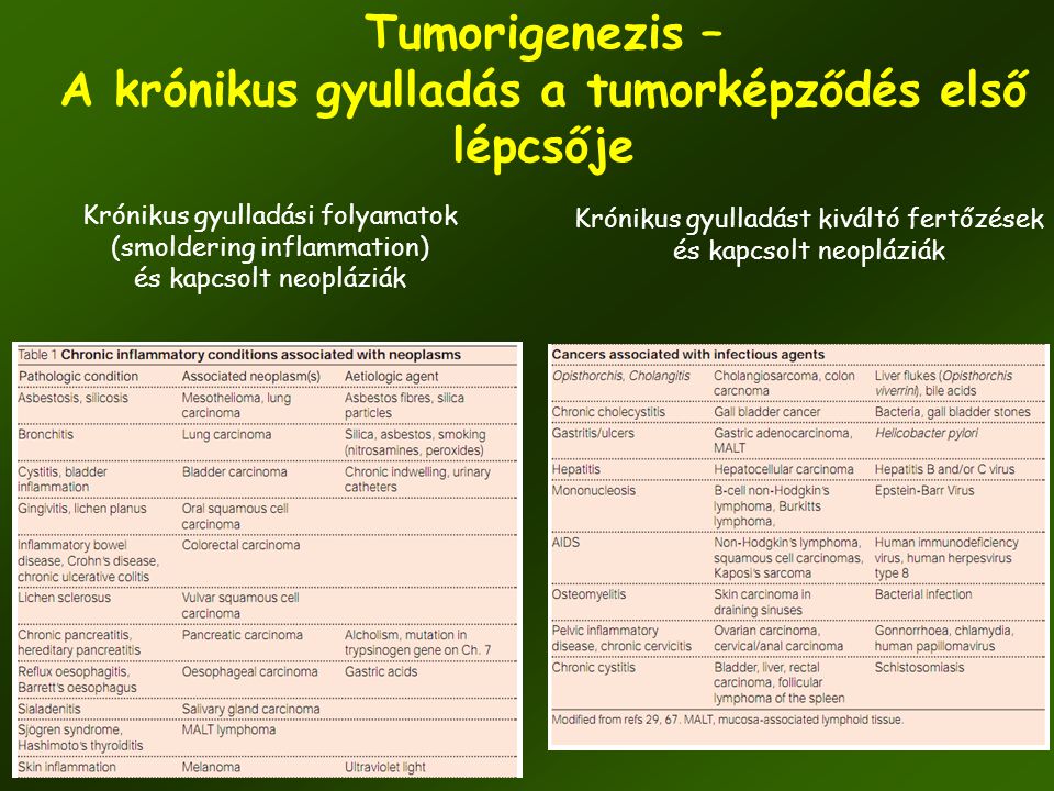 Tumorigenezis – A krónikus gyulladás a tumorképződés első lépcsője