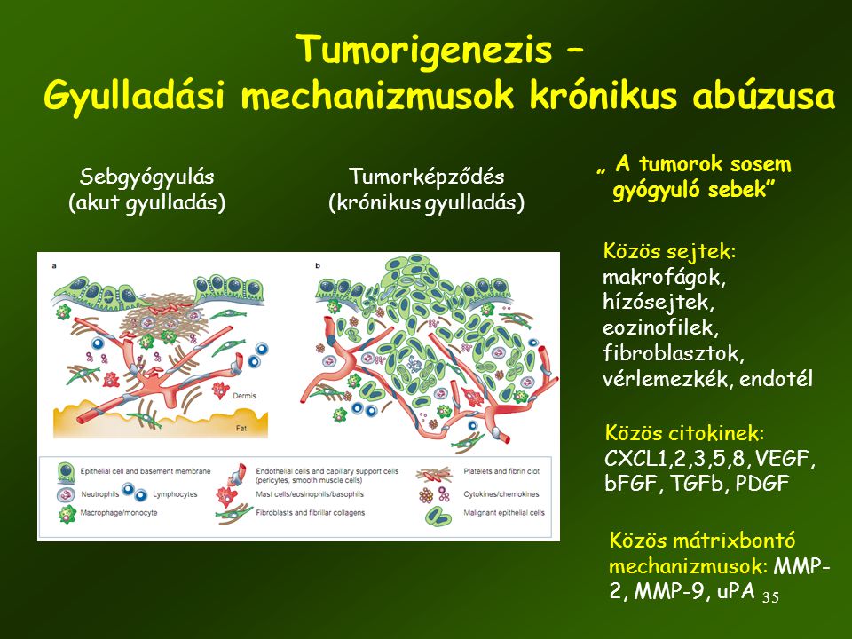 Tumorigenezis – Gyulladási mechanizmusok krónikus abúzusa
