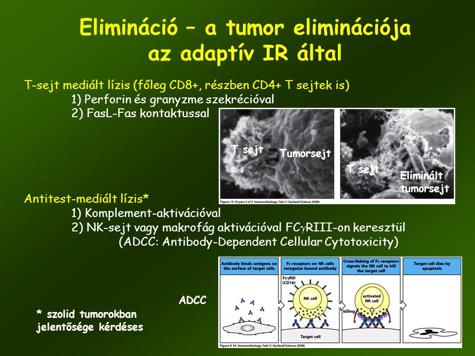 Elimináció – a tumor eliminációja az adaptív IR által