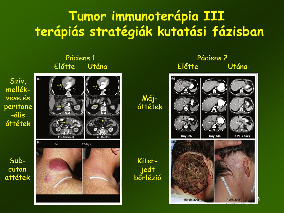 Tumor immunoterápia III terápiás stratégiák kutatási fázisban