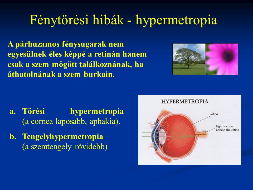 hyperopia kezelés lényege a kezelés)