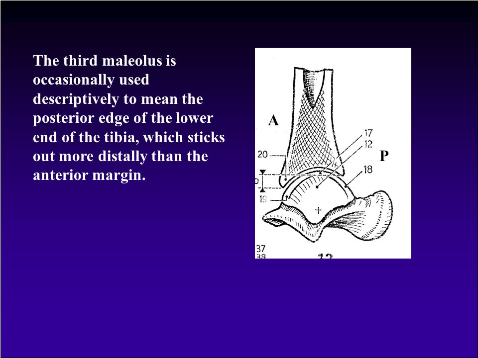 The third maleolus is occasionally used descriptively to mean the posterior edge of the lower end of the tibia, which sticks out more distally than the anterior margin.