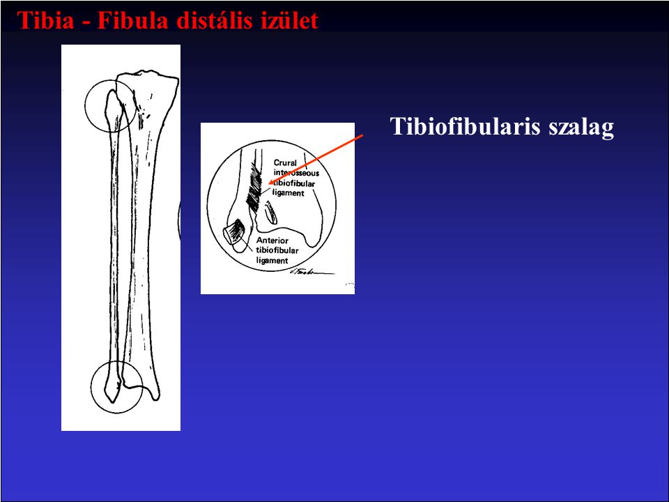Tibia - Fibula distális izület Tibiofibularis szalag
