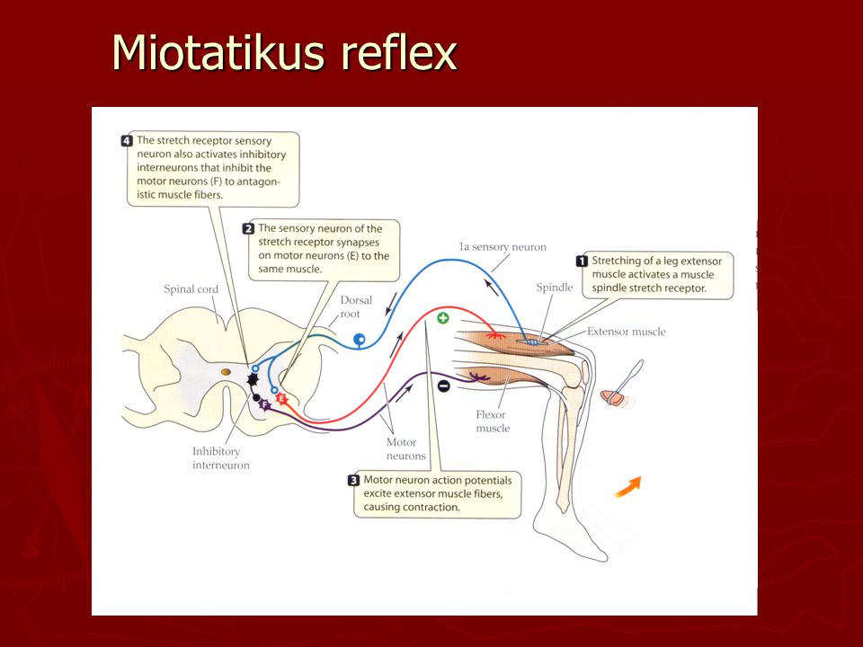Miotatikus reflex