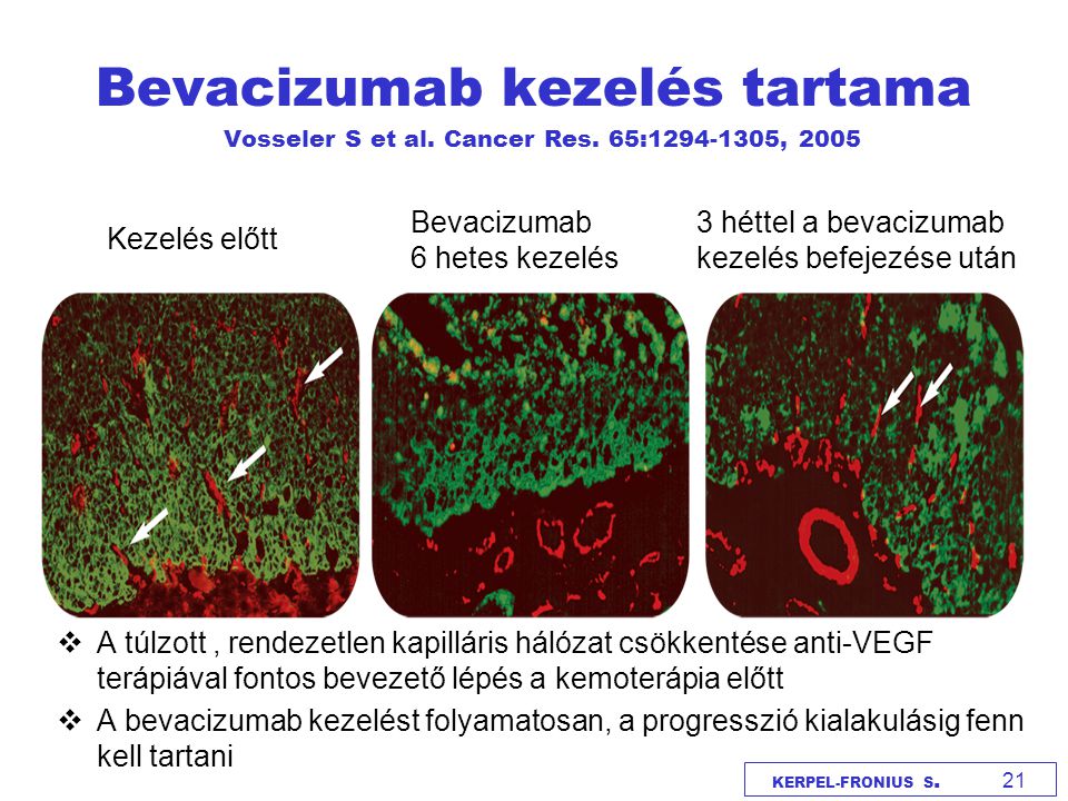 Bevacizumab kezelés tartama Vosseler S et al. Cancer Res