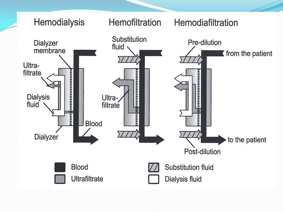 From: A Grassmann et al., Composition and Management of Hemodialysis Fluids; Pabst Publishers, 2000