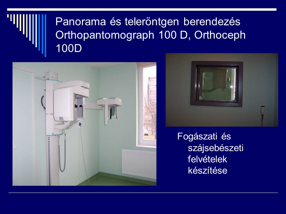 Panorama és teleröntgen berendezés Orthopantomograph 100 D, Orthoceph 100D