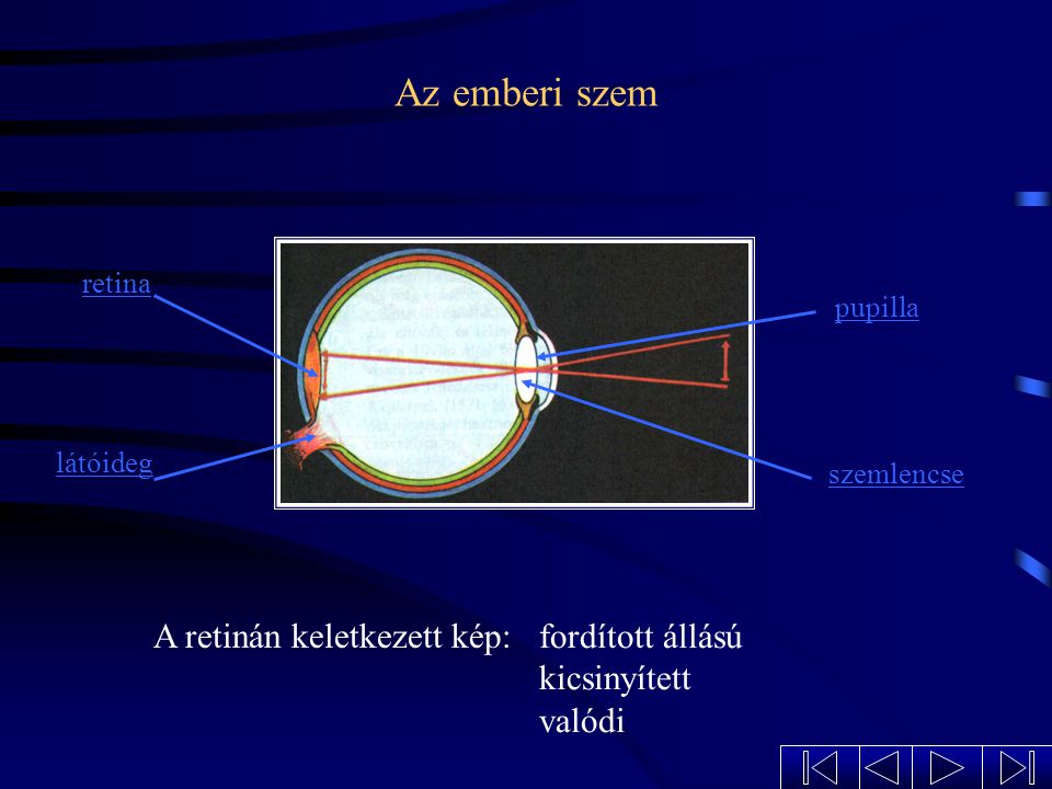 Az emberi szem A retinán keletkezett kép: fordított állású