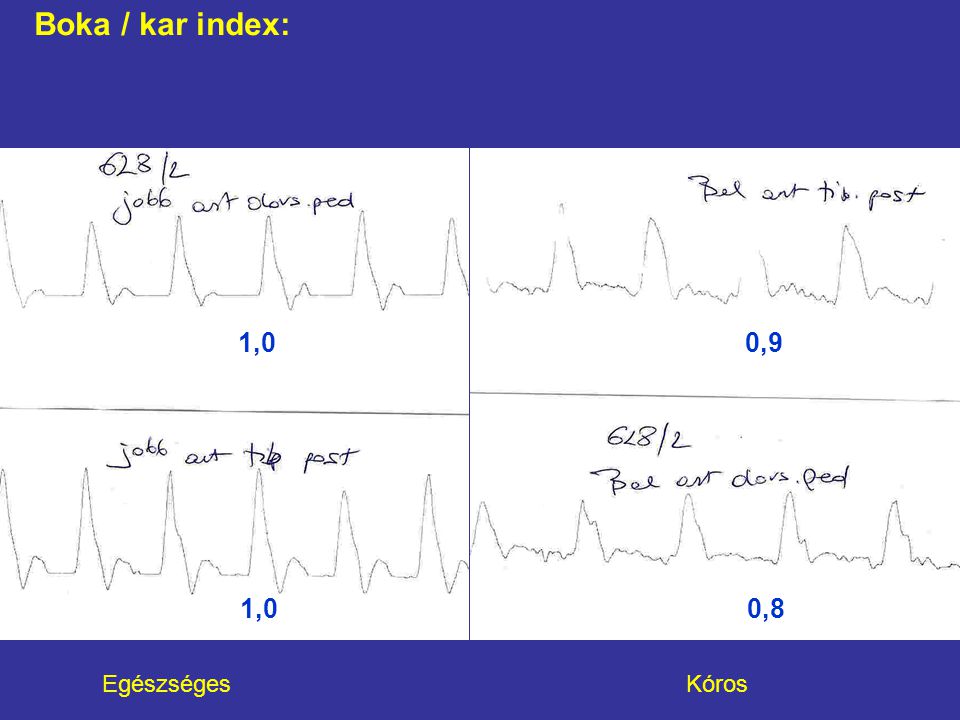 Boka / kar index: 1,0 0,9.