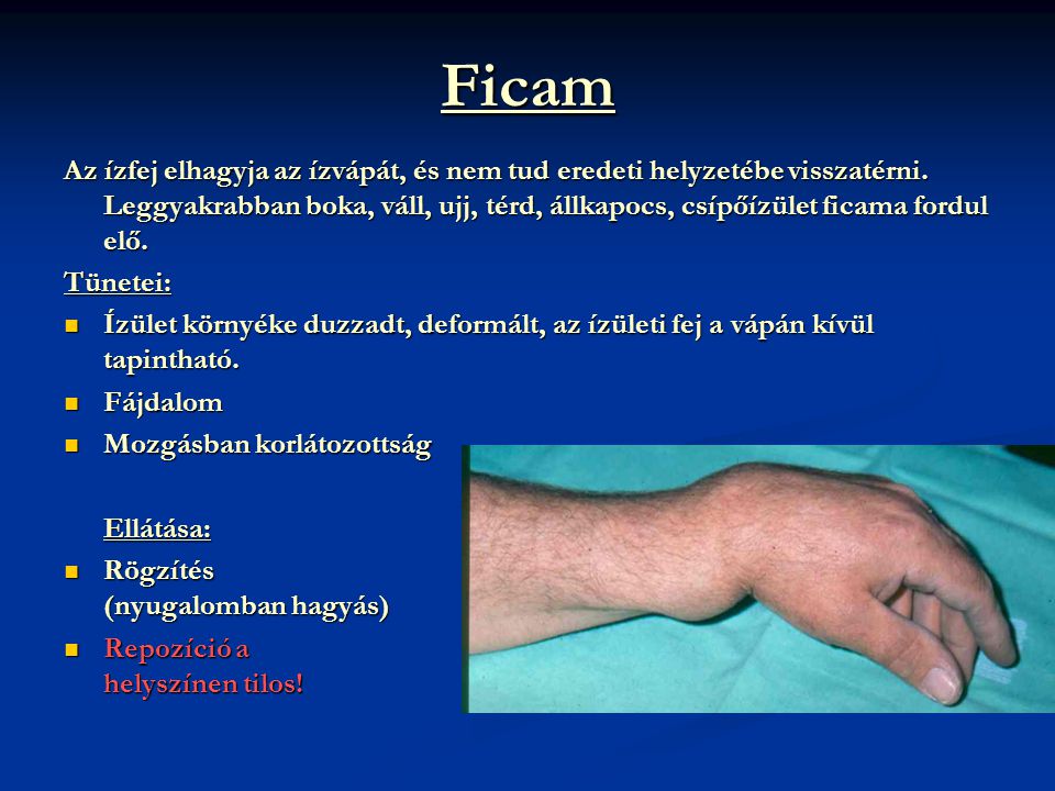ízületi fájdalom ujja a kezét ízületi fájdalom a diprospan injekció után