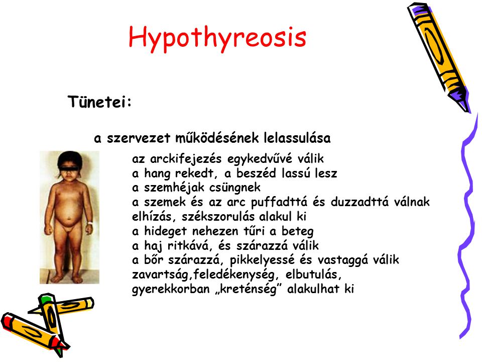 Hypothyreosis Tünetei: a szervezet működésének lelassulása