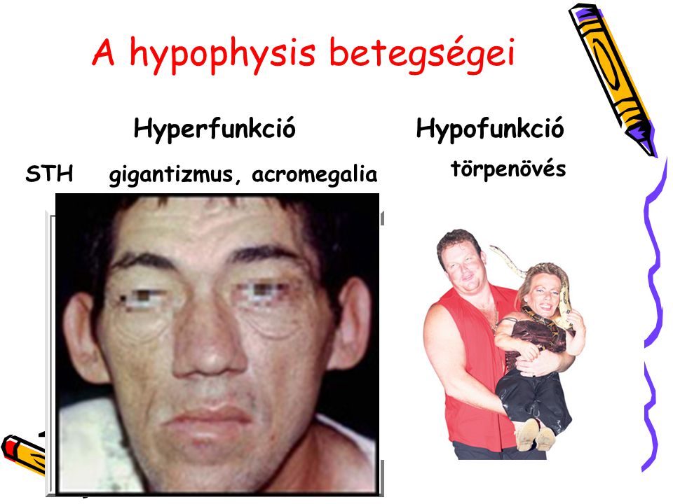 A hypophysis betegségei