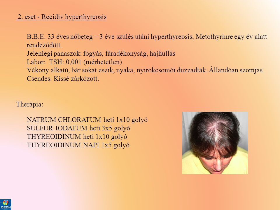 2. eset - Recidiv hyperthyreosis