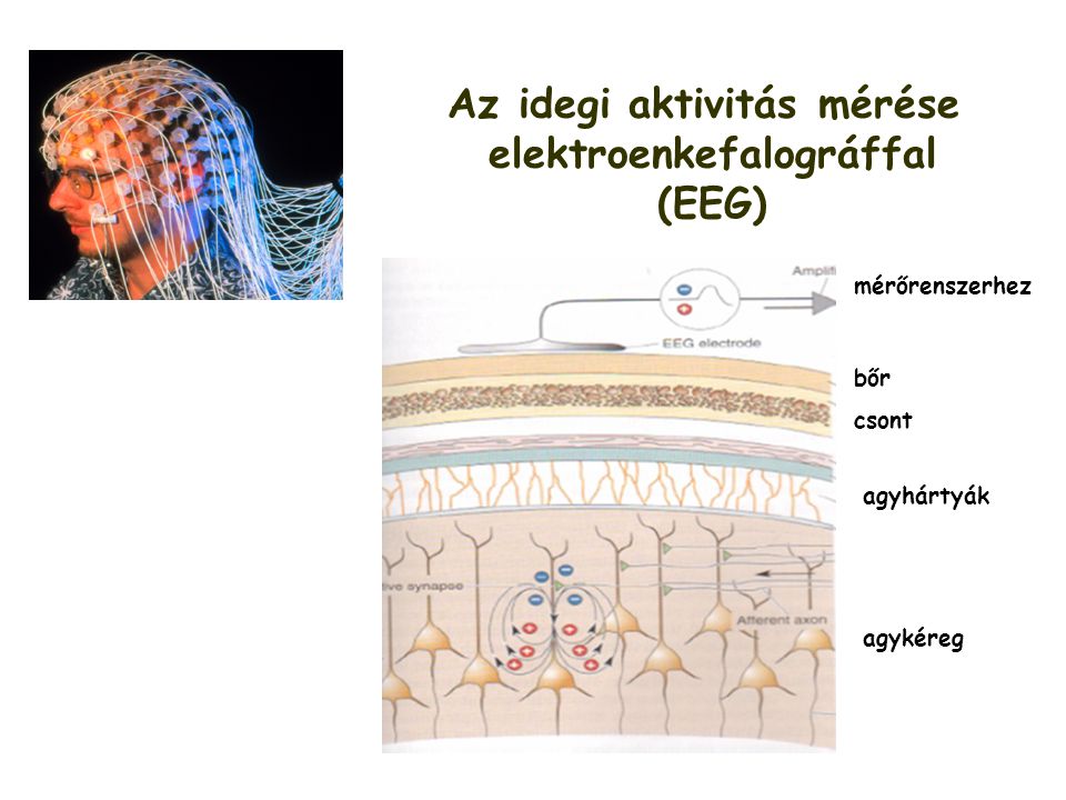 Az idegi aktivitás mérése elektroenkefalográffal