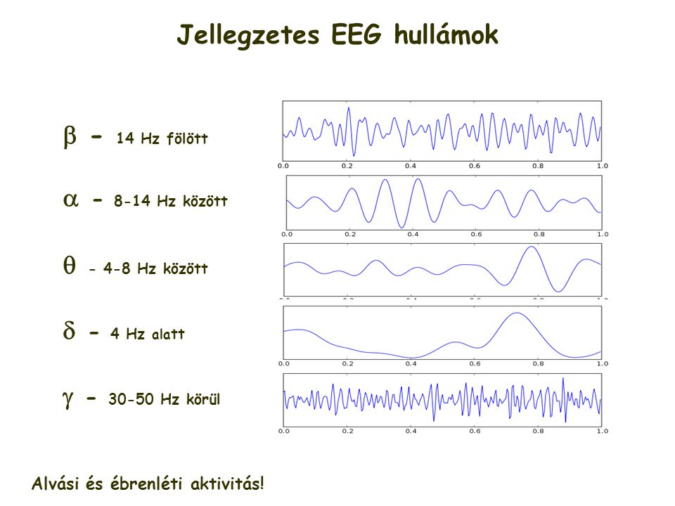 Jellegzetes EEG hullámok