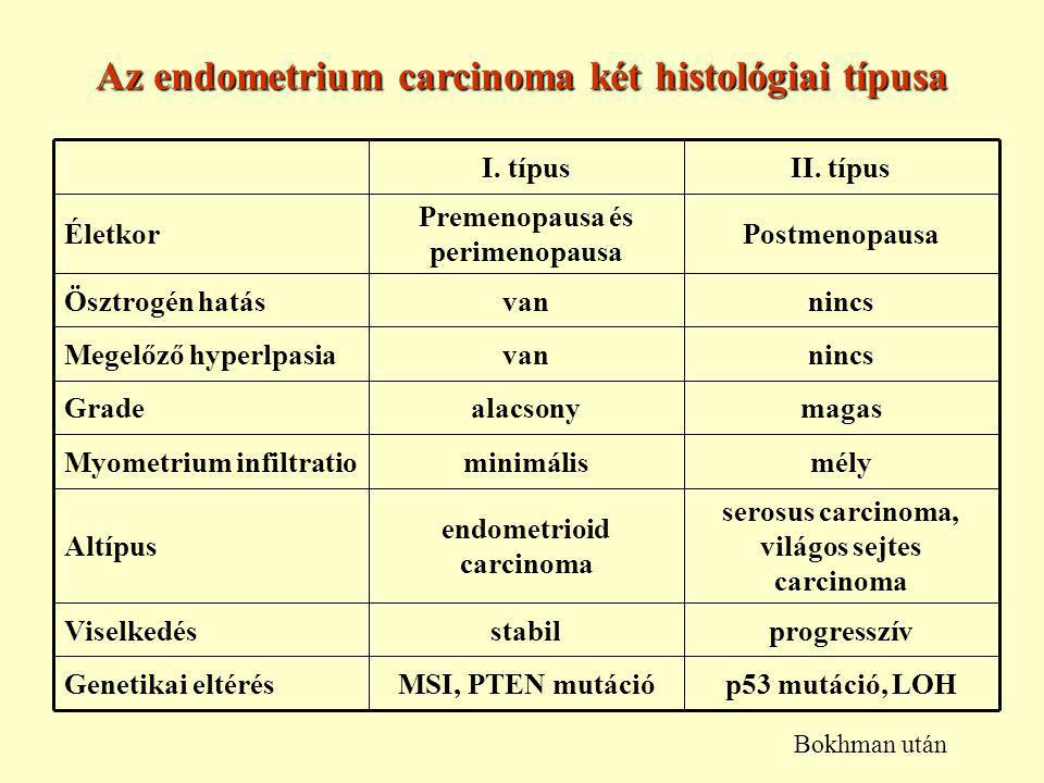 Az endometrium carcinoma két histológiai típusa