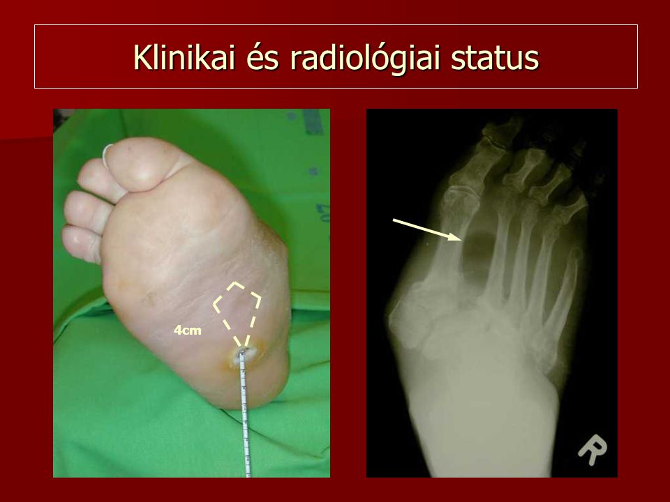 Klinikai és radiológiai status