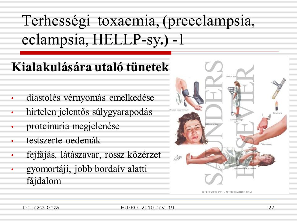 Terhességi toxaemia, (preeclampsia, eclampsia, HELLP-sy.) -1