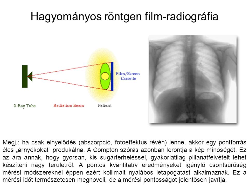 Hagyományos röntgen film-radiográfia