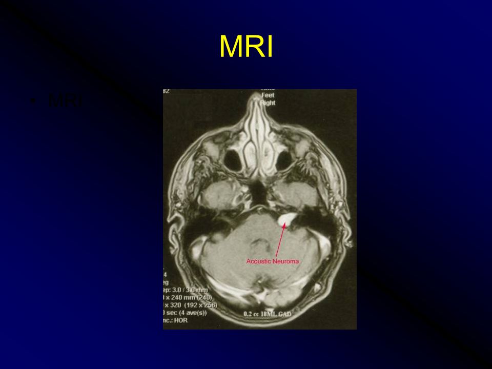 MRI MRI