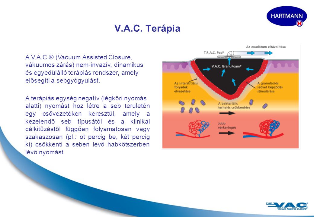 V.A.C. Terápia A V.A.C.® (Vacuum Assisted Closure,