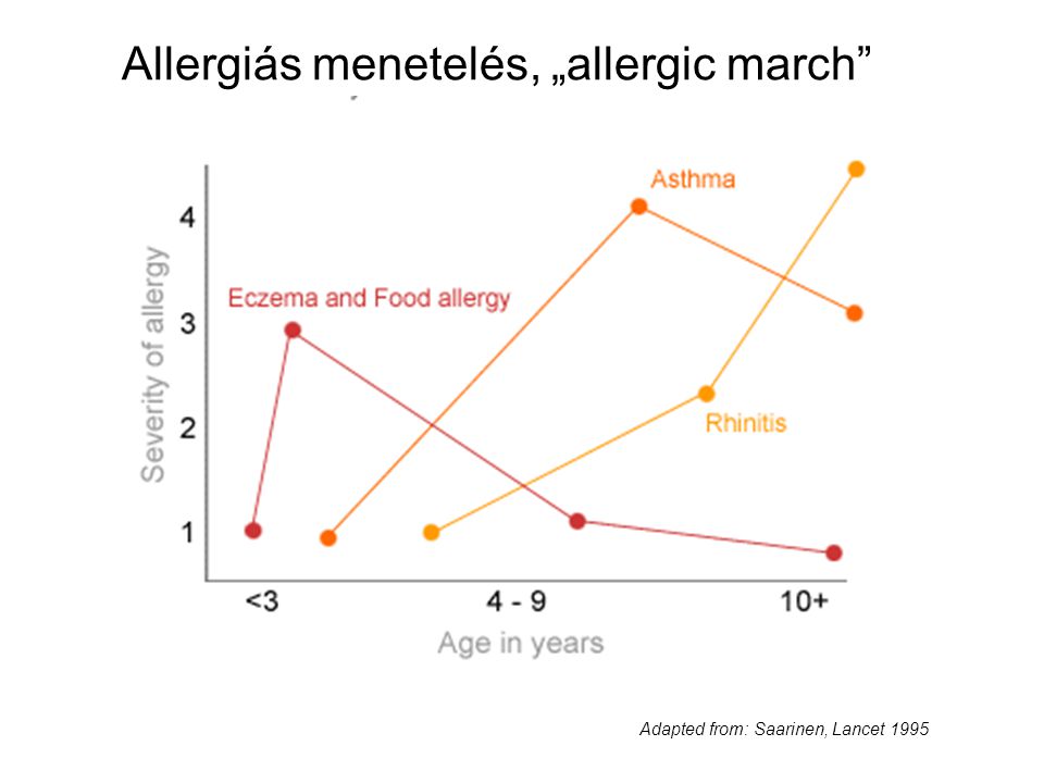 Allergiás menetelés, „allergic march