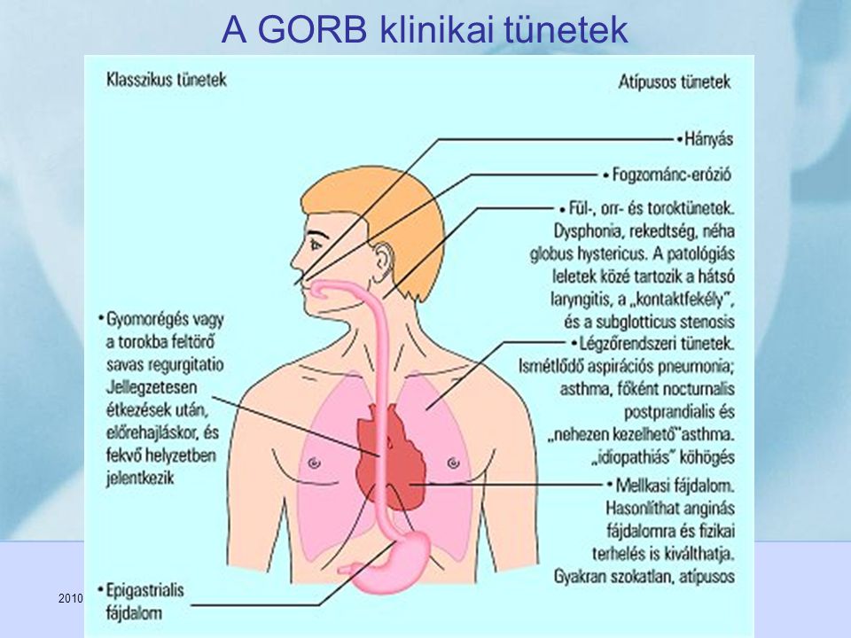 A GORB klinikai tünetek