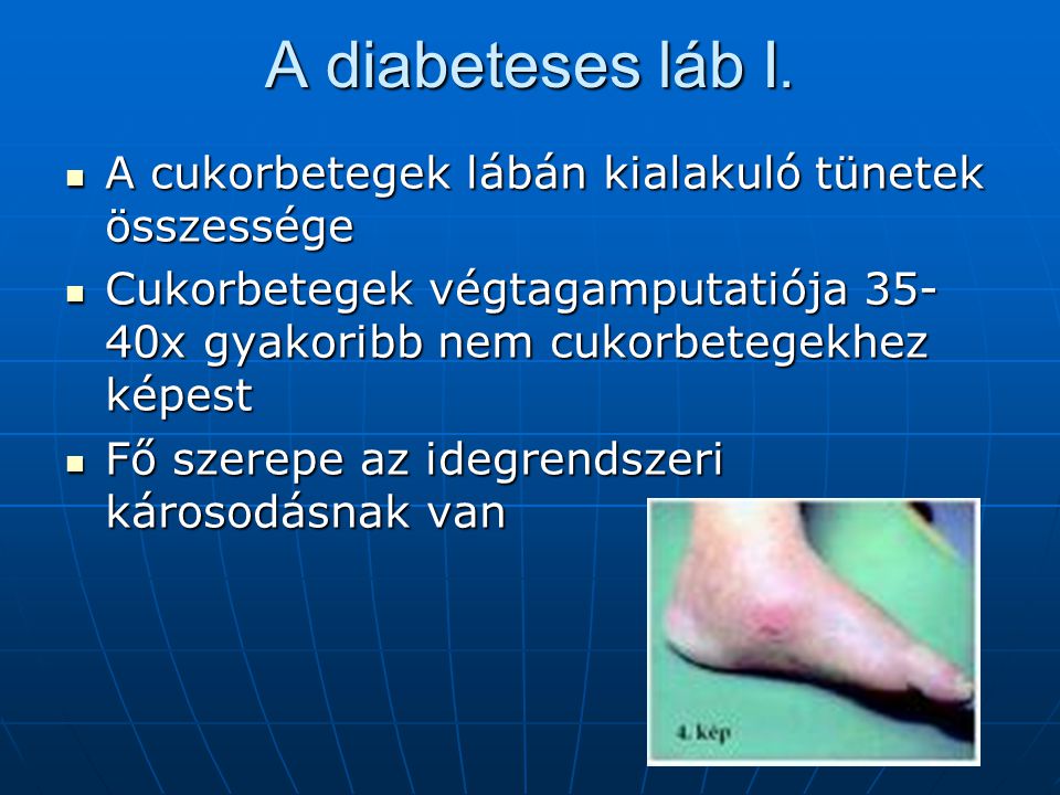Diabéteszes lábápolás - Pap Izabella Lábcentrum