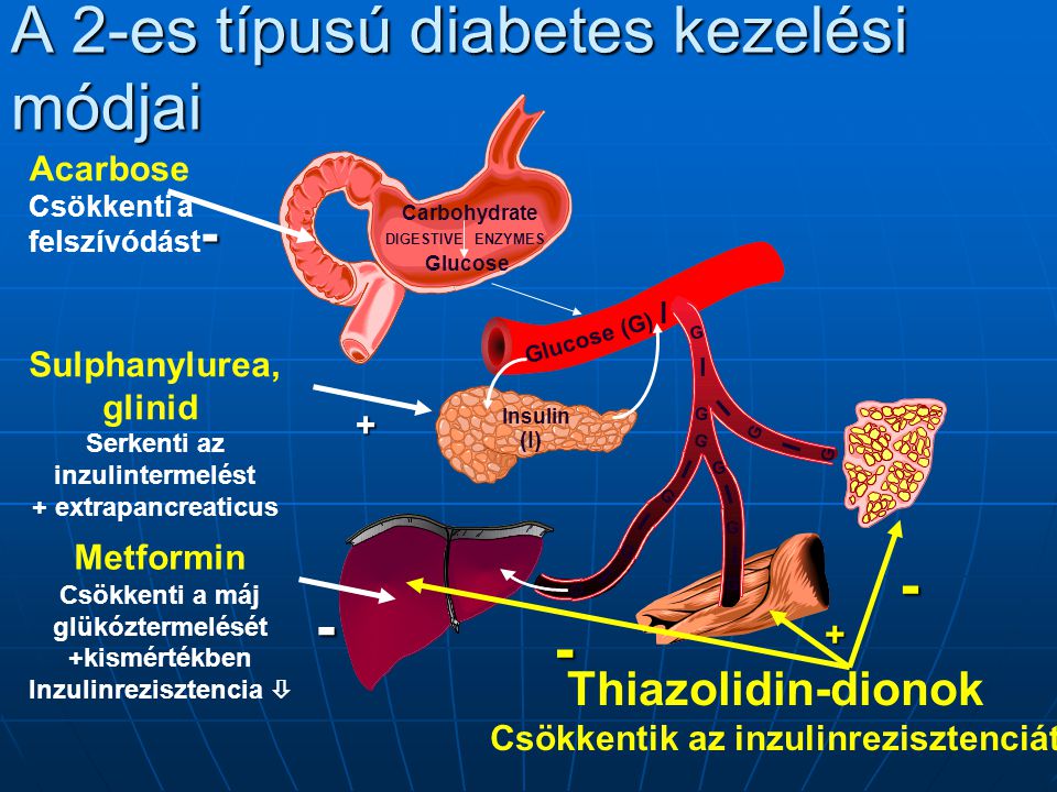 mi serkenti az inzulintermelést kezelése topinamburg 2. típusú cukorbetegségben