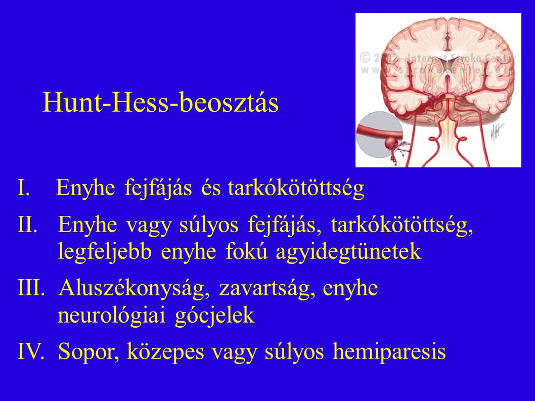Hunt-Hess-beosztás I. Enyhe fejfájás és tarkókötöttség